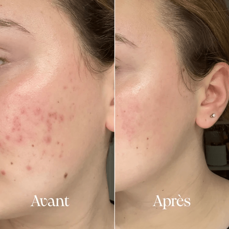 Robinet de soins de la peau et filtre de douche série Pro - Hydraneo