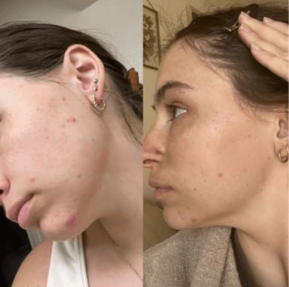 Robinet de soins de la peau et filtre de douche série Pro - Hydraneo