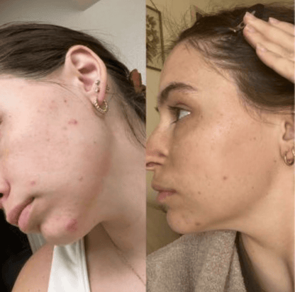 Robinet de soins de la peau et filtre de douche série Pro - Hydraneo