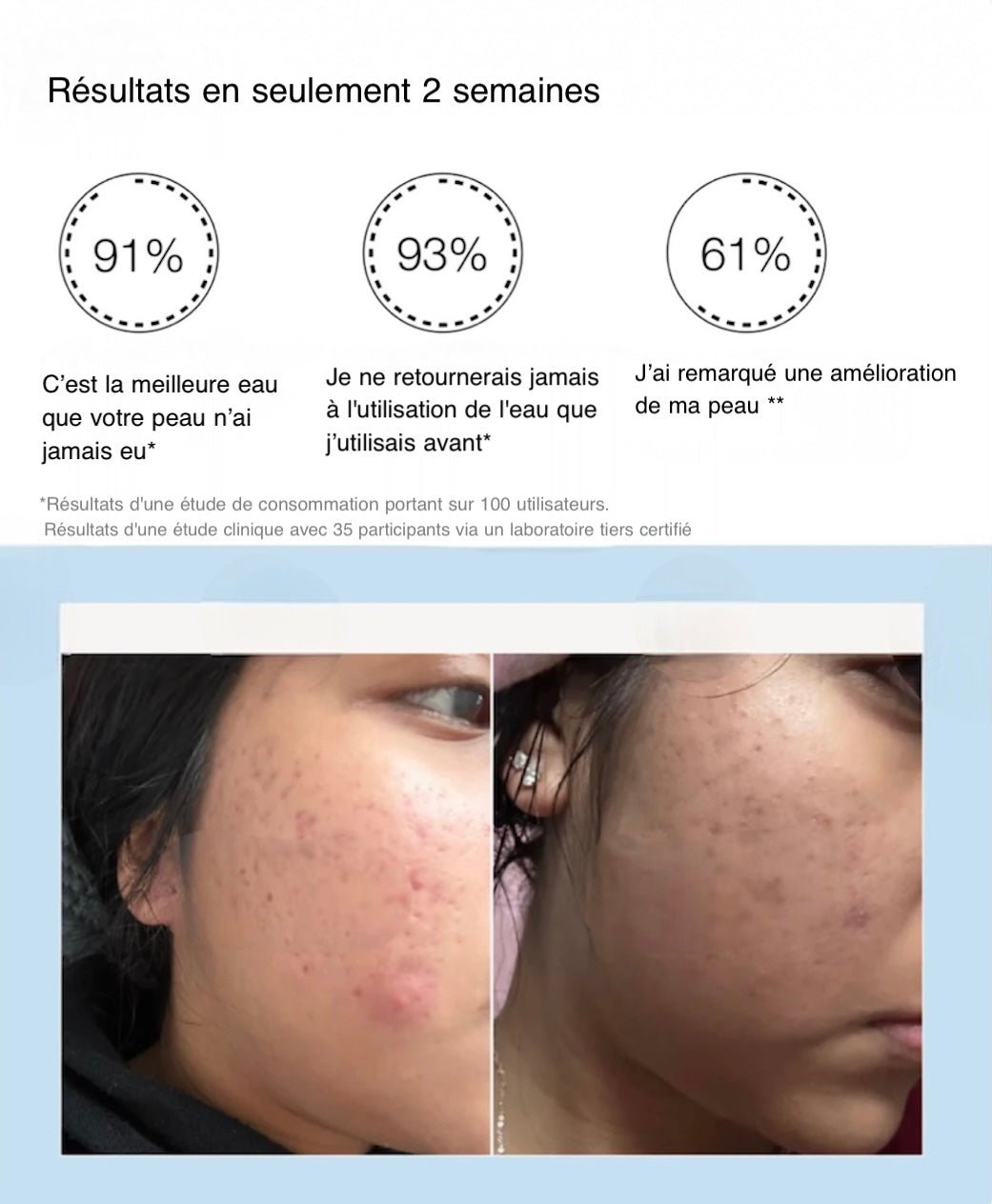 Robinet de soins de la peau et filtre de douche série Pro - Hydraneo